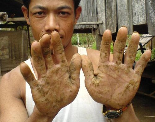 Nhận Biết Nước Nhiễm Asen, Nguyên Nhân Tác Hại Và Cách Xử Lý