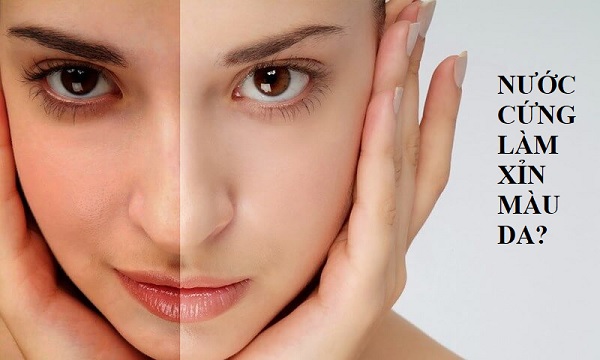 Nước Cứng Làm Xỉn Màu Da Thật Hay Không? Giải Pháp Xử Lý