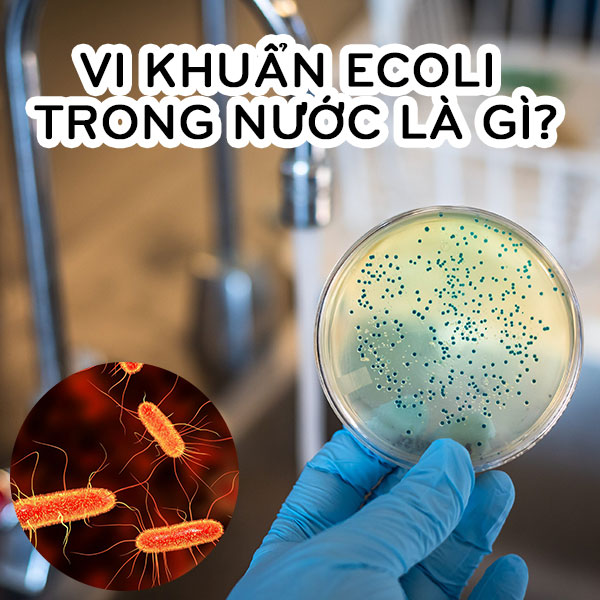 Xử Lý Nước Nhiễm E Coli Bằng Cách Nào Để Tránh Gây Hại Sức Khỏe